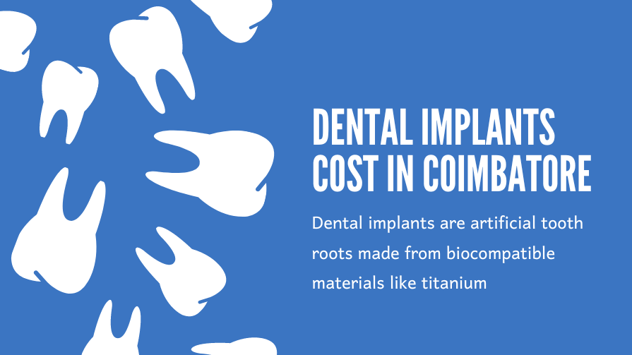Dental Implants Cost in Coimbatore: A Comprehensive Guide